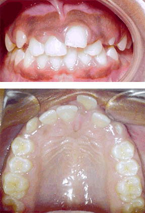 Orthodontic Gallery Case 8 