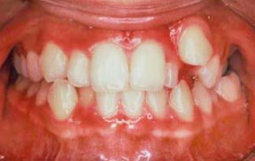 Orthodontic Gallery Case 3 