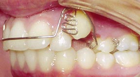 Orthodontic Gallery Case 7 