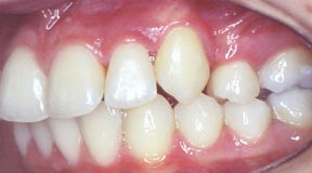 Orthodontic Gallery Case 7 