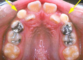 Orthodontic Gallery Case 9 